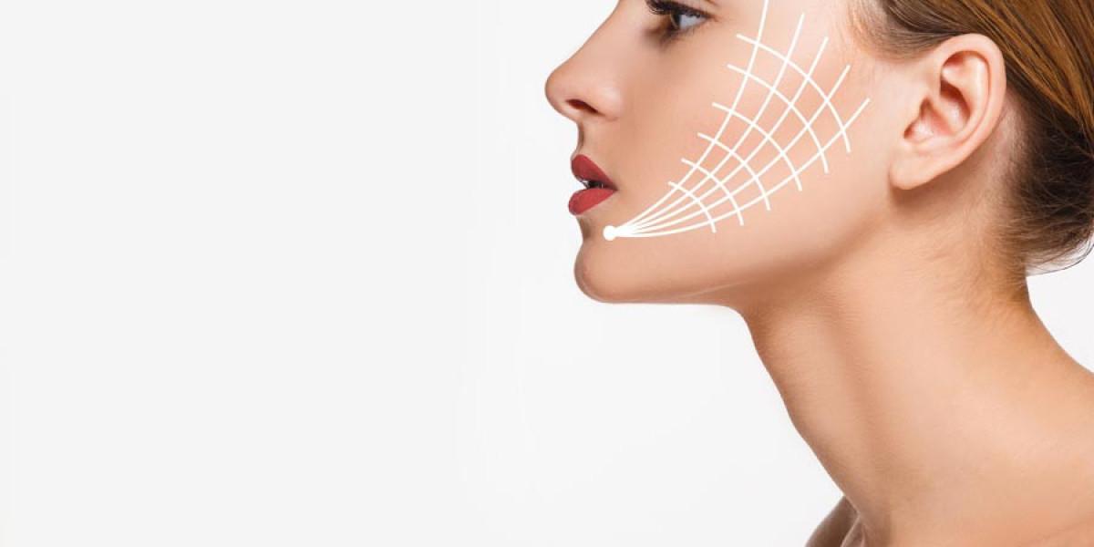 How Natural Do Results Look After a Thread Lift?