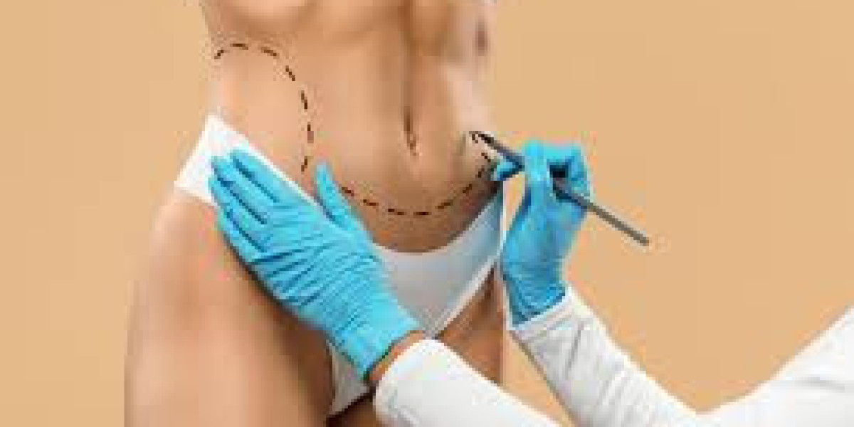 Defining Your Physique: The Complete Guide to Male Liposuction in Dubai