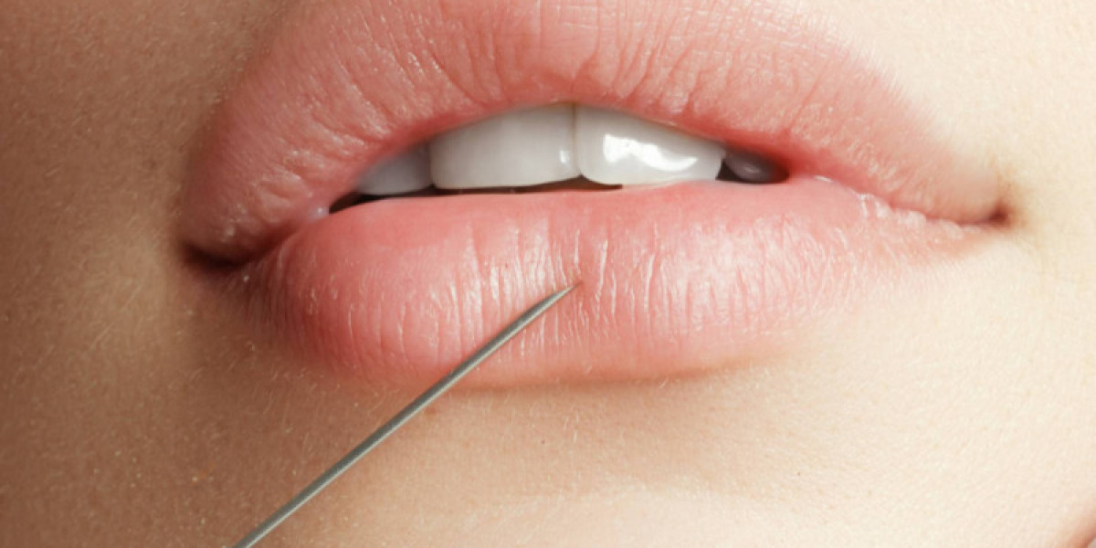 When Is the Right Age for Russian Lip Fillers in Dubai?