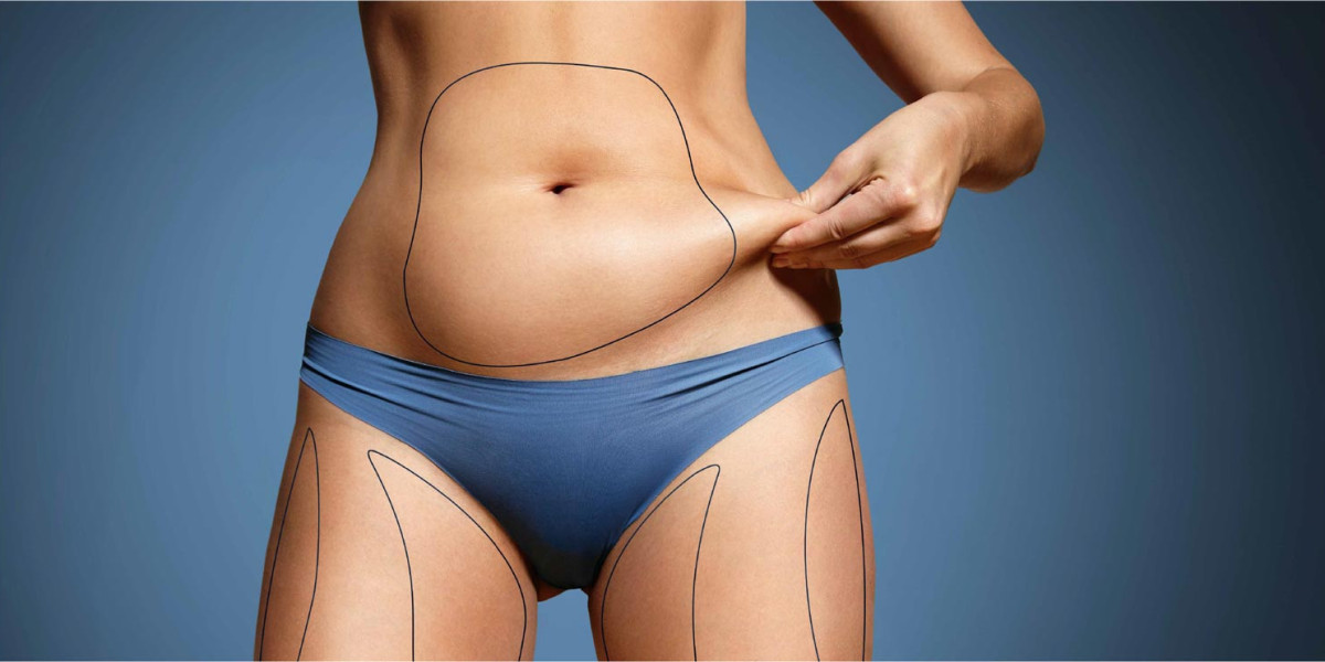How Do Surgeons Assess Skin Quality for Lipo Abdominoplasty?