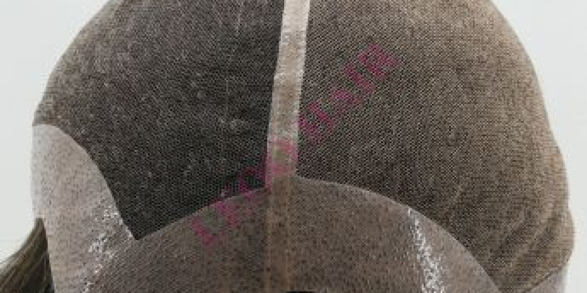 Nuova Identità con Protesi Capelli di Ultima Generazione