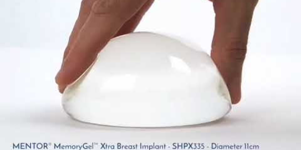 هل يمكن استبدال حشوات منتور بعد زراعة الثدي في الرياض؟