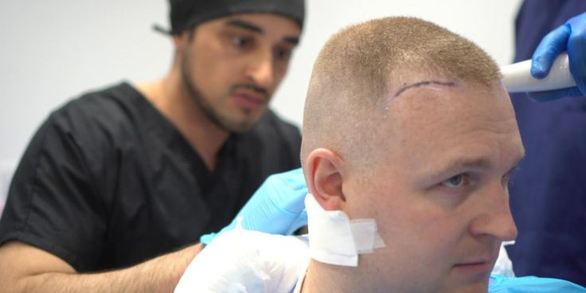 Hair Transplant for 1 Dirham Understanding the Procedure Details