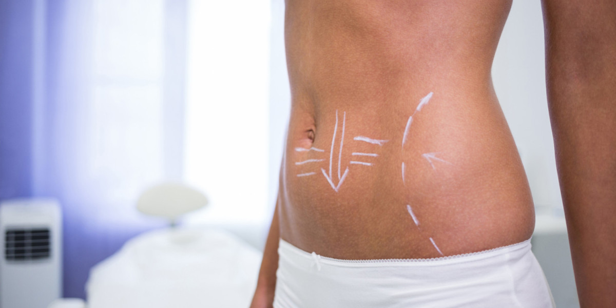 Benefits of Mini Tummy Tuck Dubai for Busy Individuals