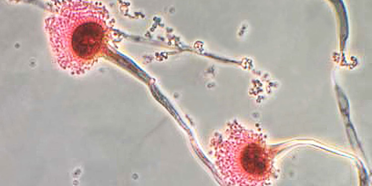 Candida Test Before Starting Diet Plans