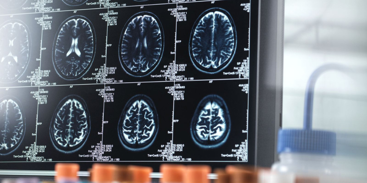 Alzheimer's Treatment in Dubai: Innovative Brain Therapies