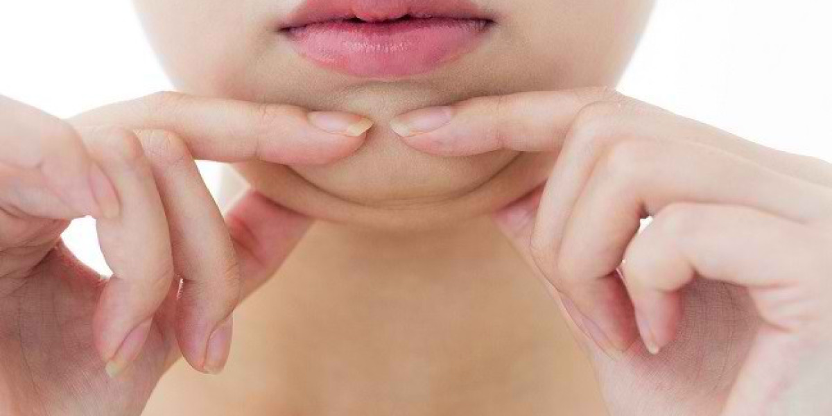 Does Age Affect Double Chin Removal Considerations?
