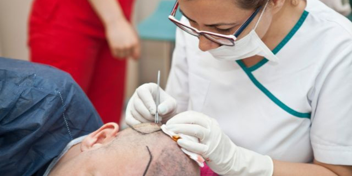 Hair Transplant Trends and Innovations in Hair Restoration