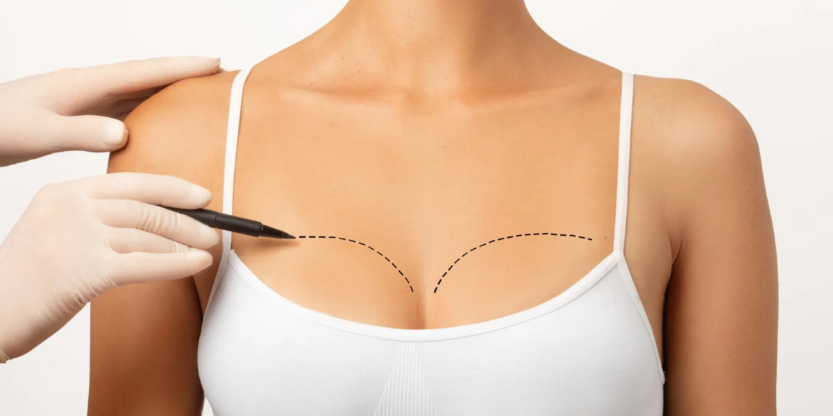 Breast Augmentation Myths vs Facts You Should Know