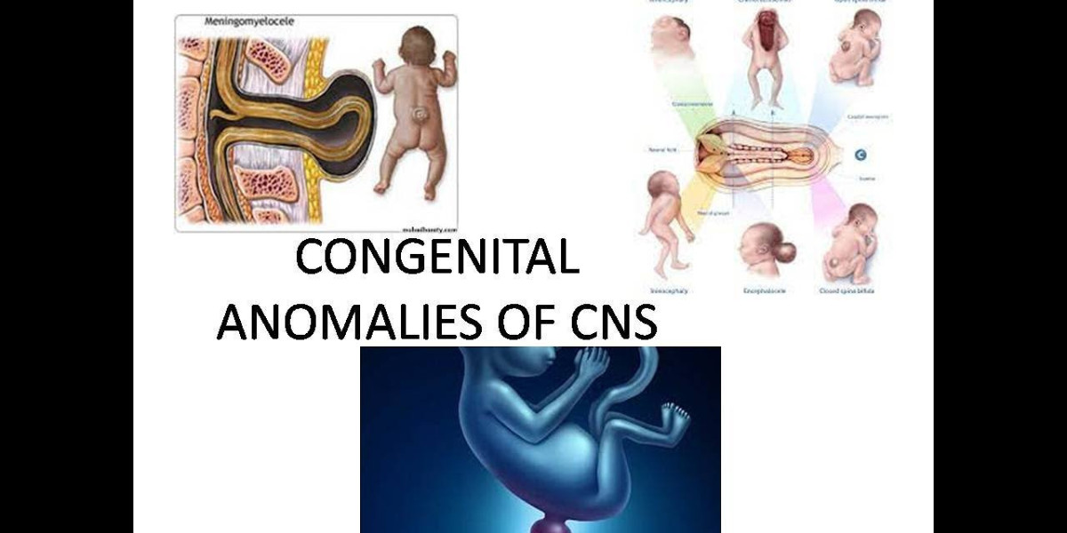 Correcting Congenital Ptosis: Surgical Techniques for Better Vision