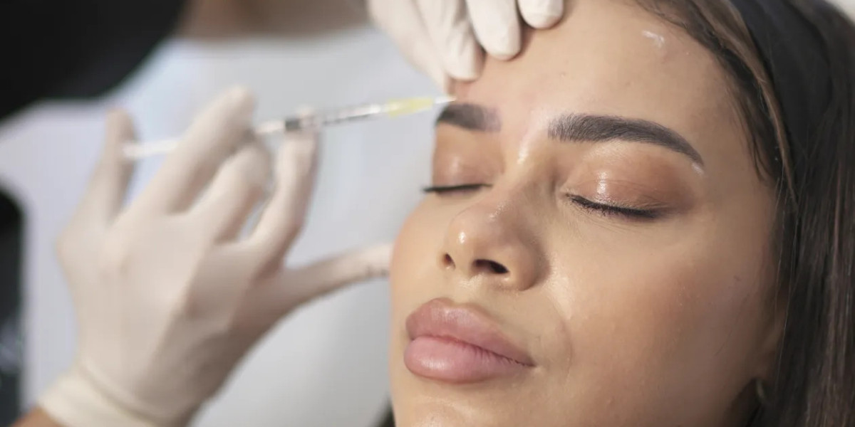 Botox Injections for Forehead Lines What You Should Know?