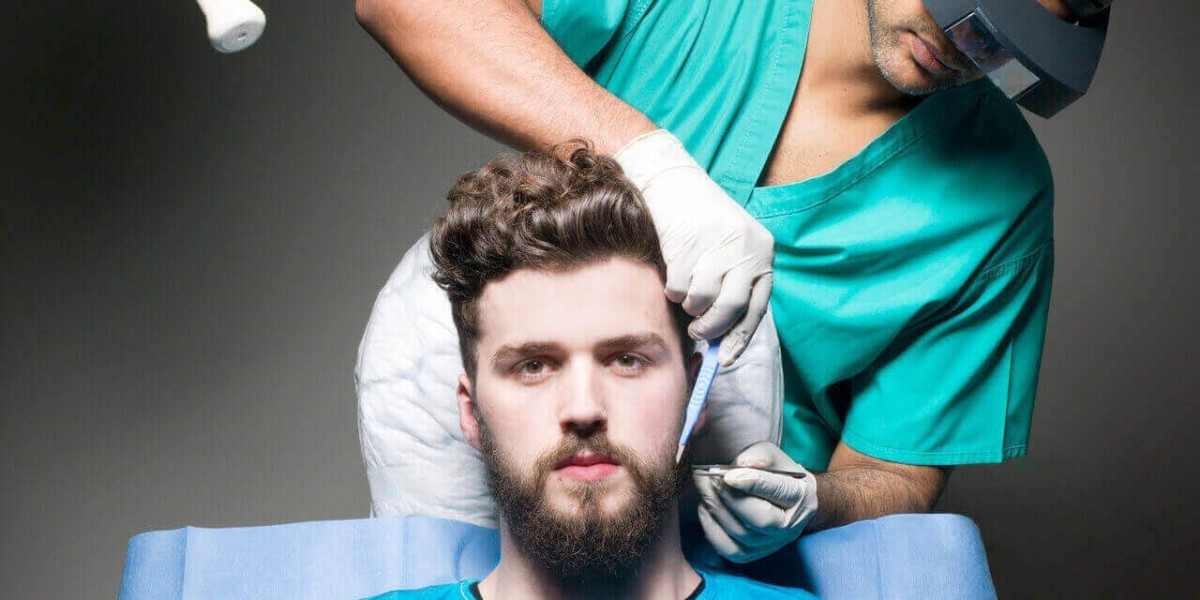 Beard transplant for scars and facial burns