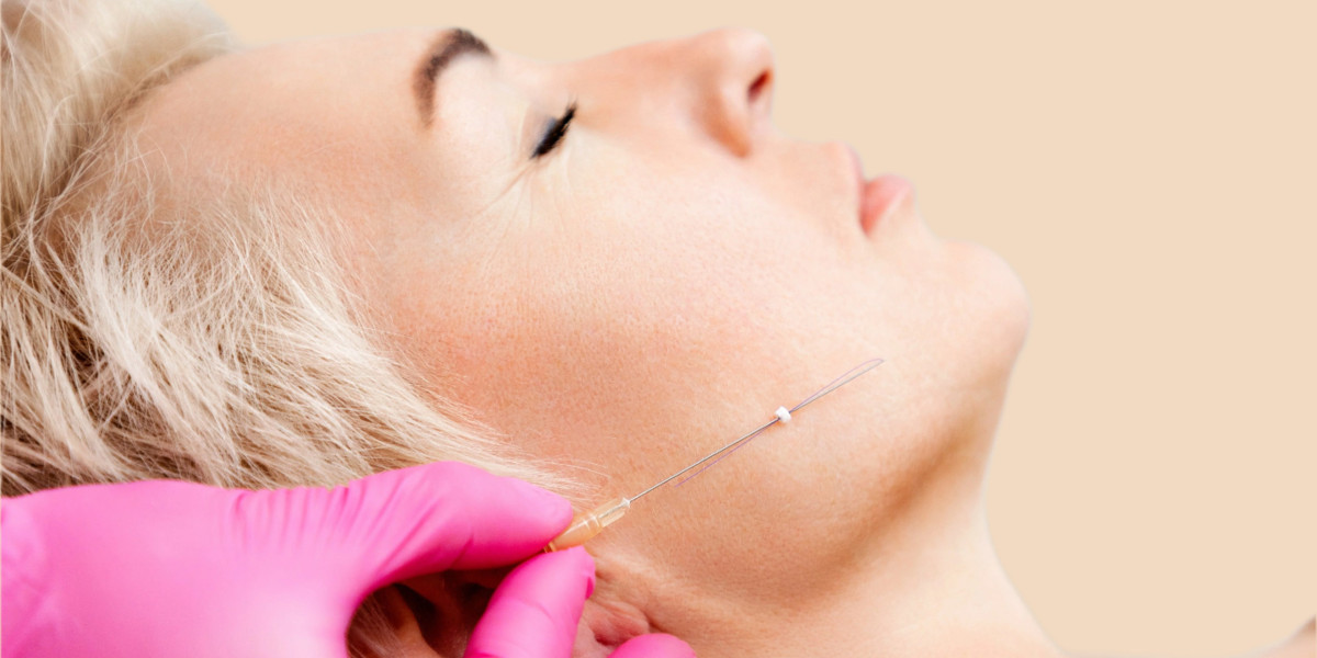 Is a thread lift suitable for skin laxity?