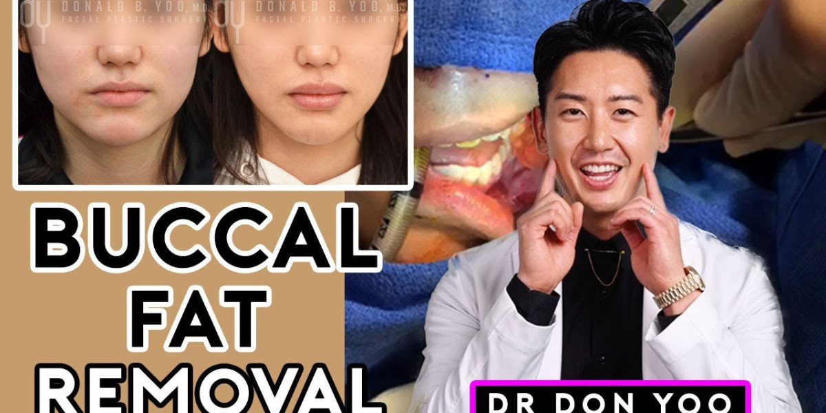 Transforming Round Faces: The Impact of Buccal Fat Surgery