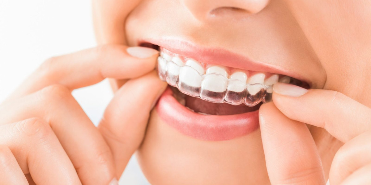 Dental Braces in Dubai Benefits for Oral Health Guide