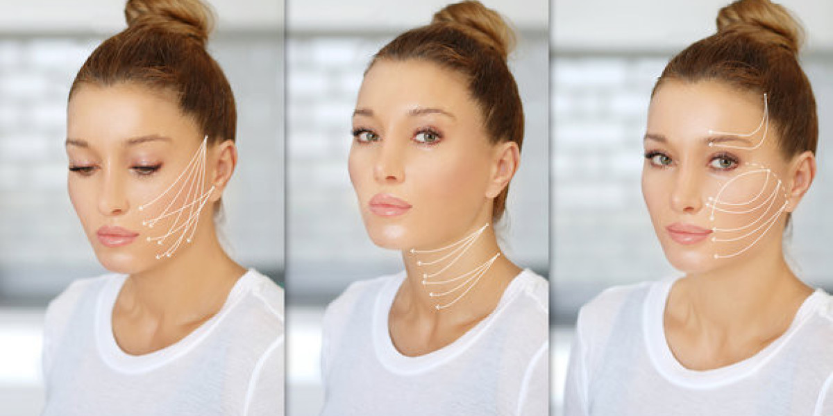Non-Surgical Excellence: Everything You Need to Know About Magic Facelifts