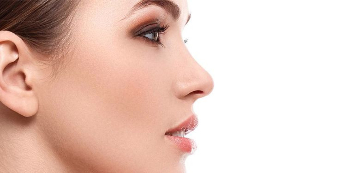 Can Rhinoplasty Be Done in Stages?