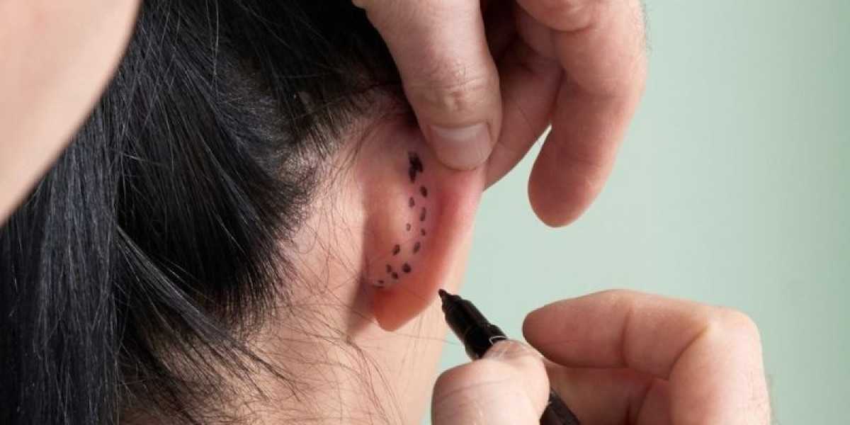 Why More Families Are Choosing Otoplasty Surgery in India — And What You Should Know Before You Decide