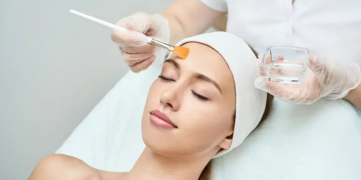 Chemical Peel Recovery Time: Healing Tips & Timeline